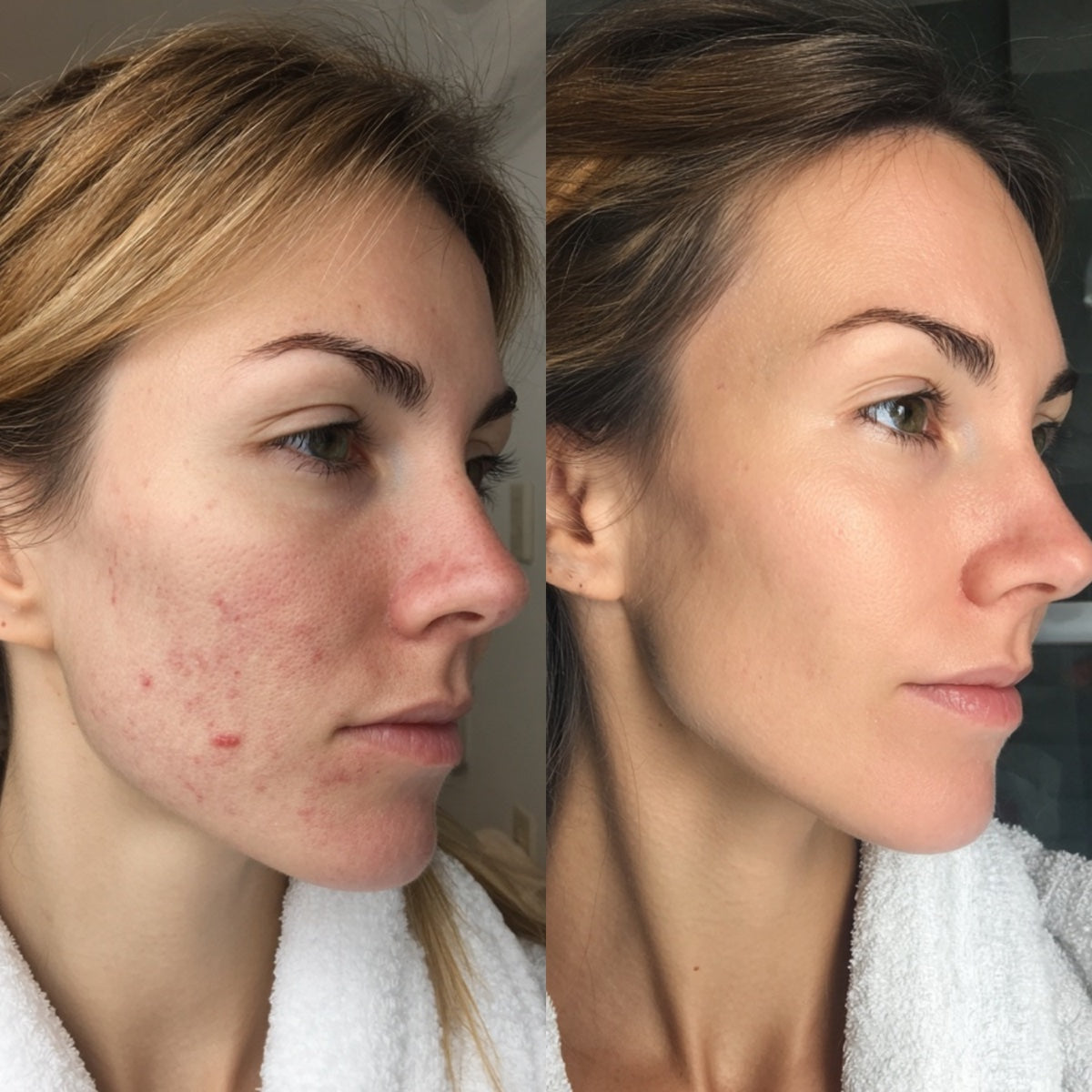After — Day 30