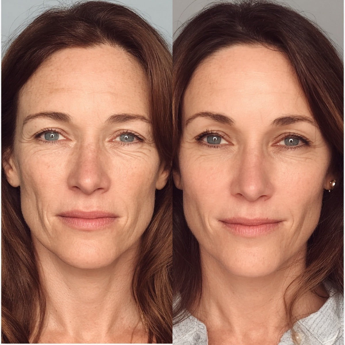 After — Day 30