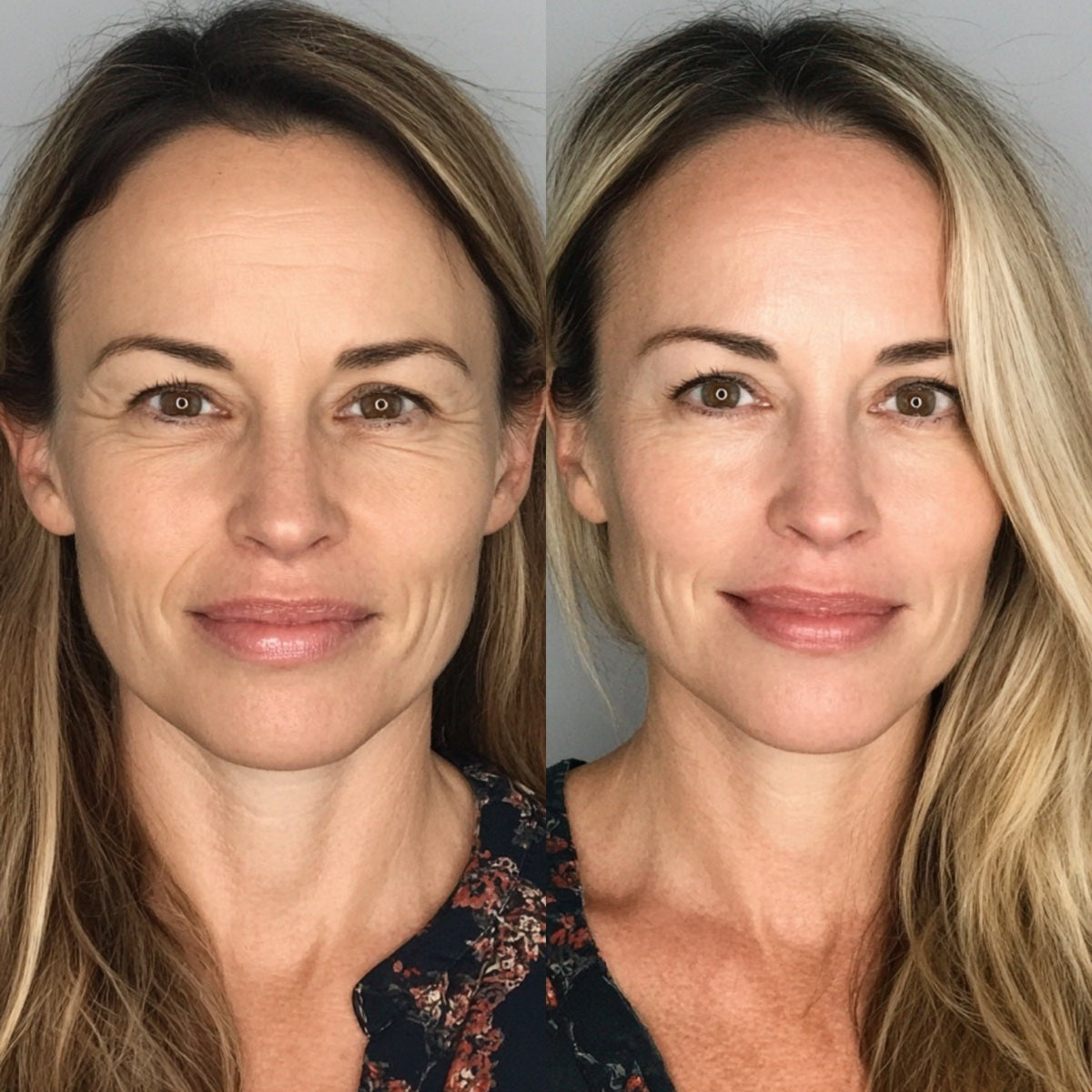 After — Day 30