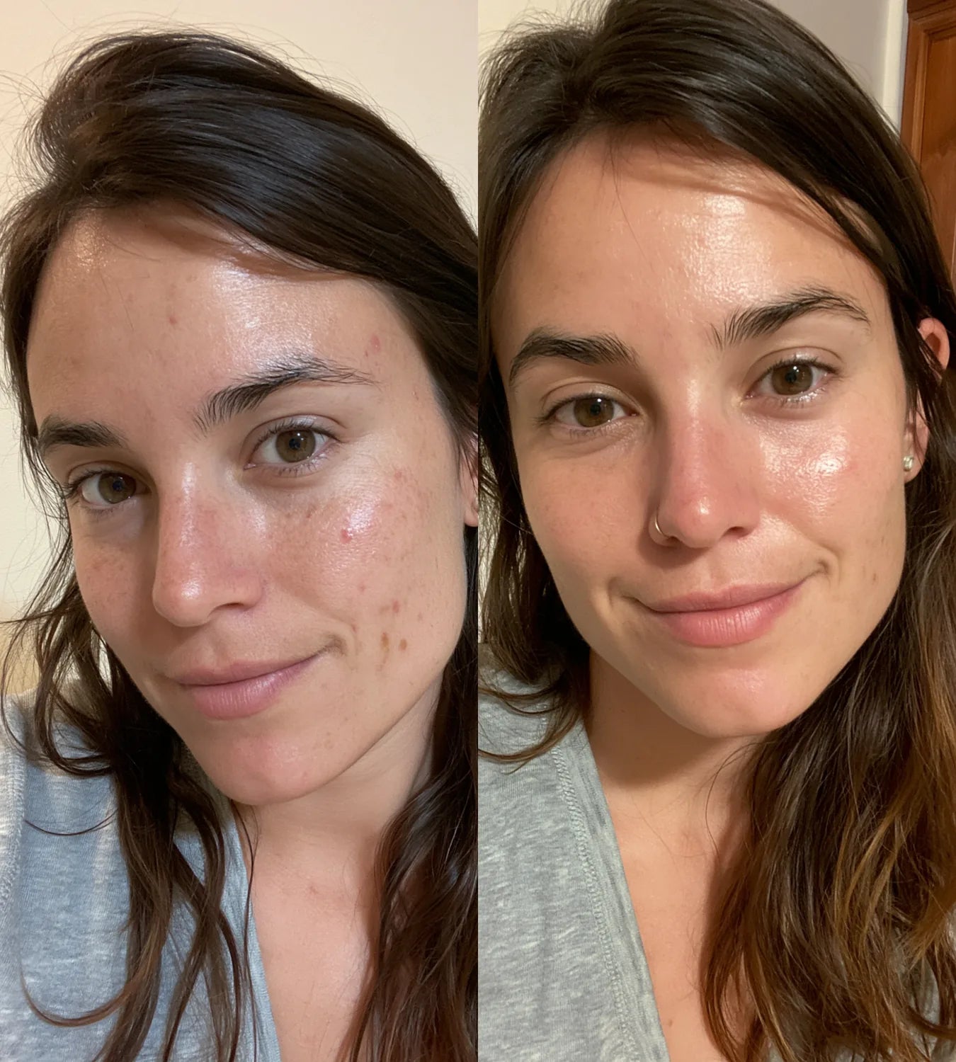 ARCHER before and after result