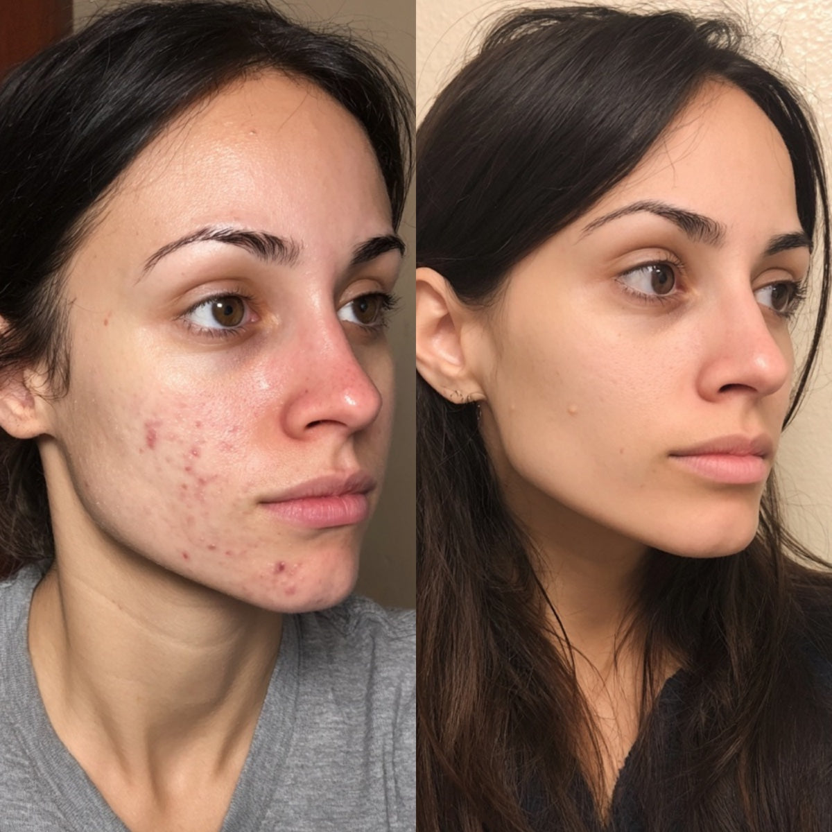 After — Day 30
