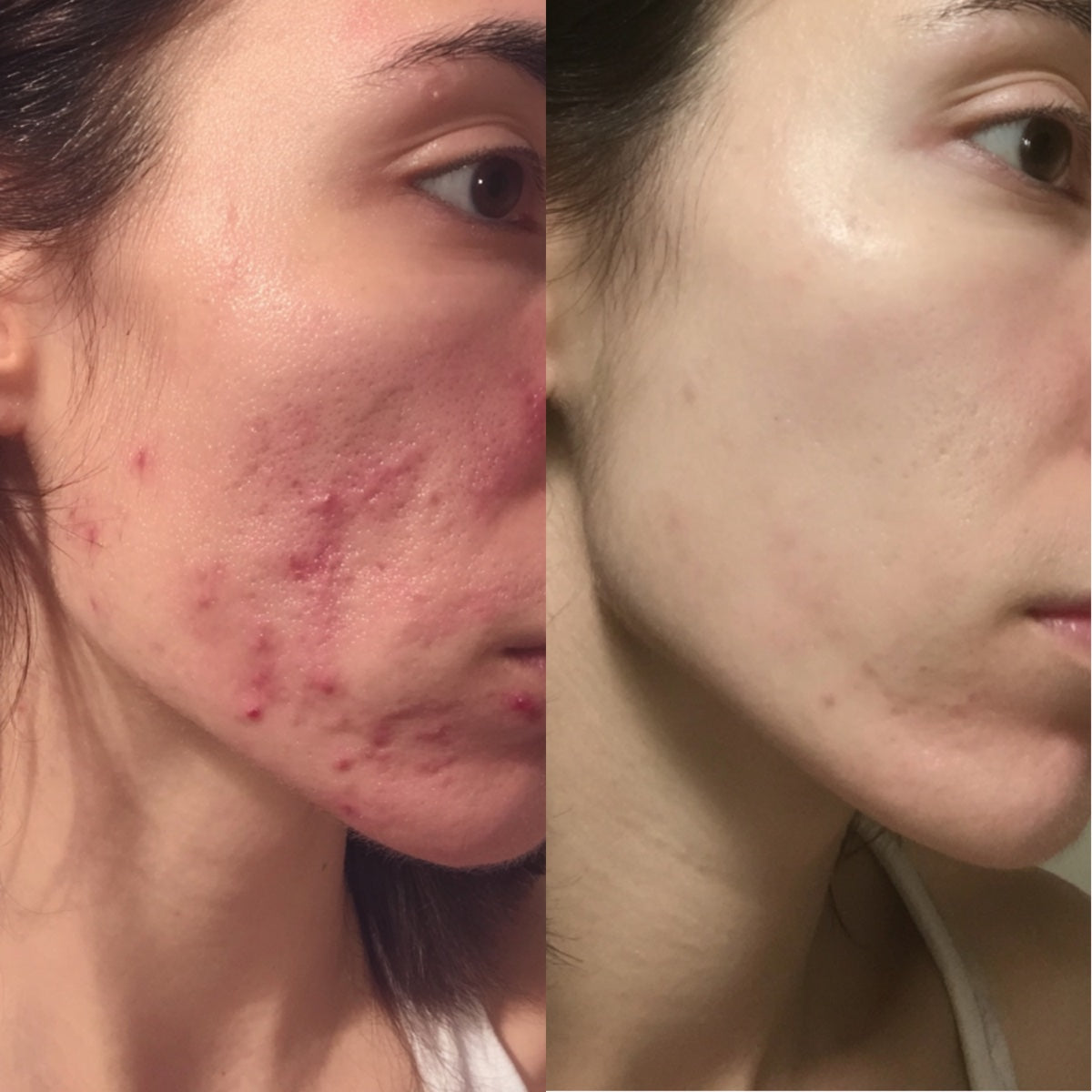 After — Day 30