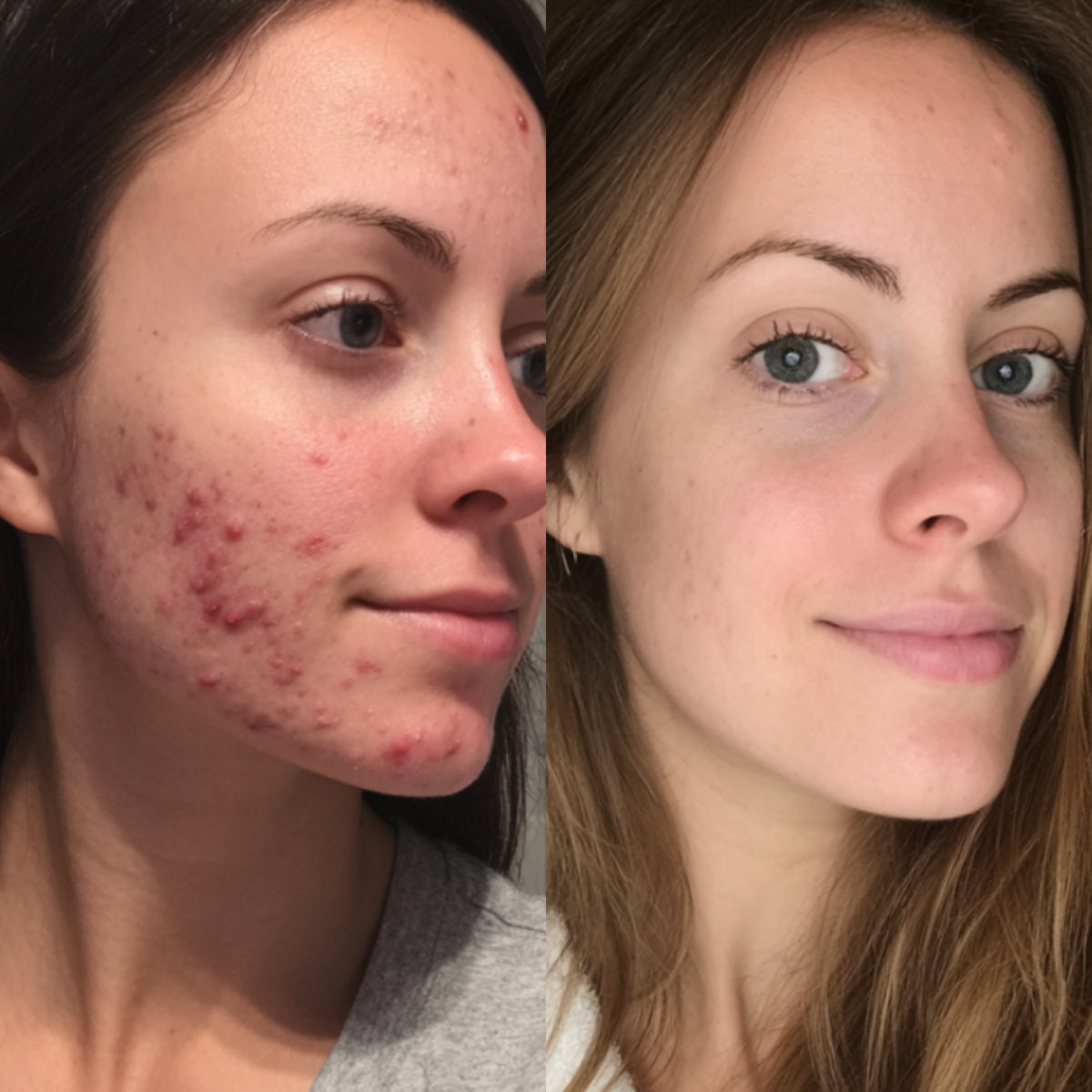 After — Day 30