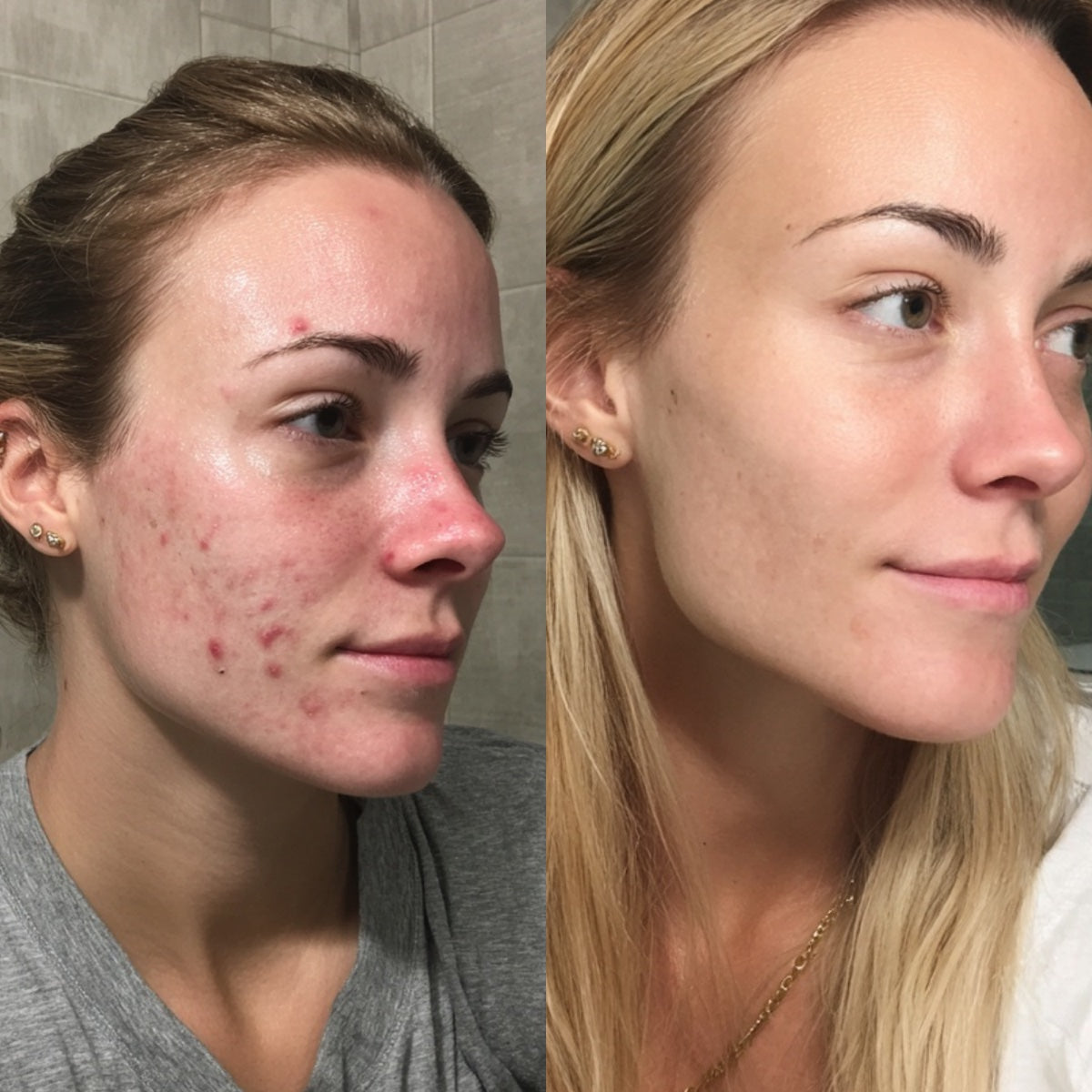 After — Day 30