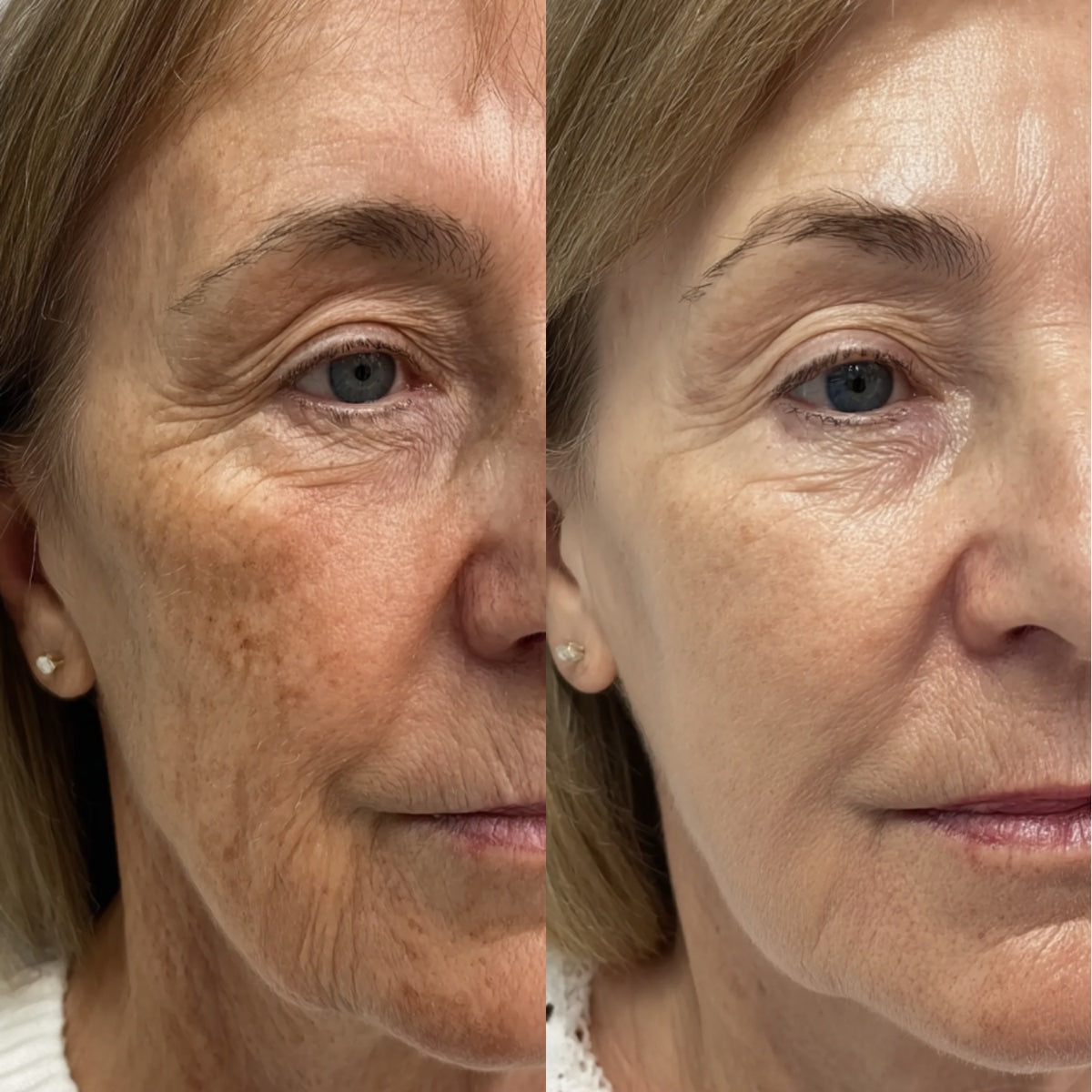 After — Day 30